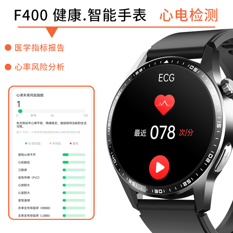小狮F400无创血糖智能手表心电血压尿酸血脂监测蓝牙通话运动手表 - 图片 4